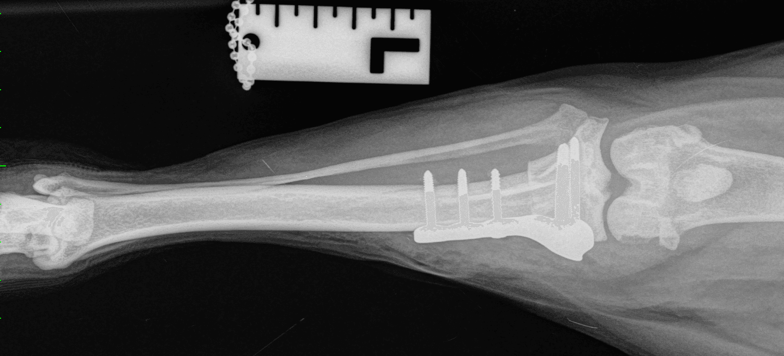 xray